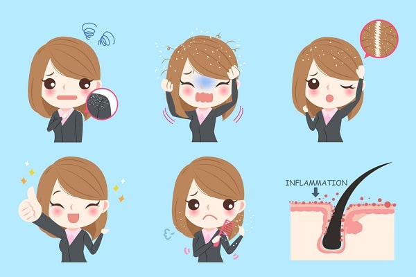 how-to-get-rid-of-dandruff