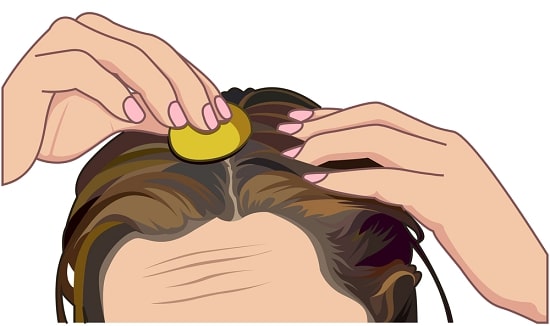 lemon-massage-on-hair-natural-dandruff-remedy